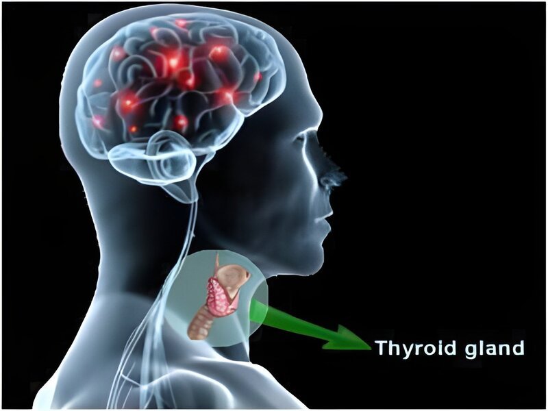 Thyroid Hormones Linked to Fear and Anxiety: New Brain Study Uncovers Hidden Connection