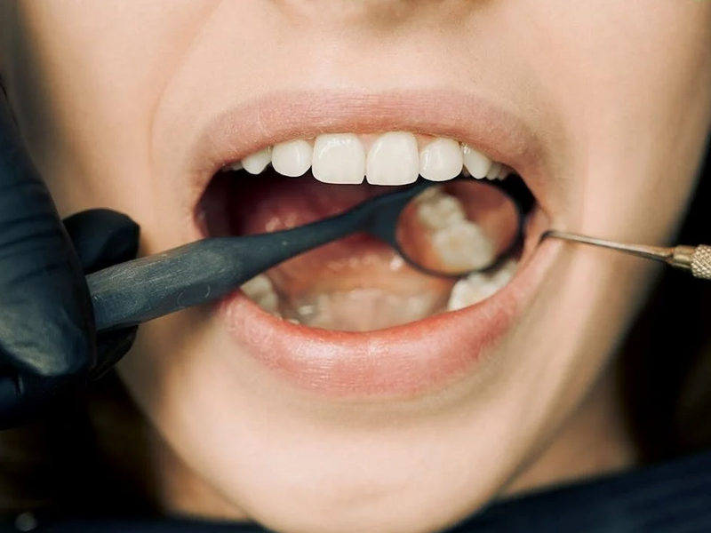 Japan Begins Human Trials for Groundbreaking Tooth Regrowth Treatment Developed at Kyoto University