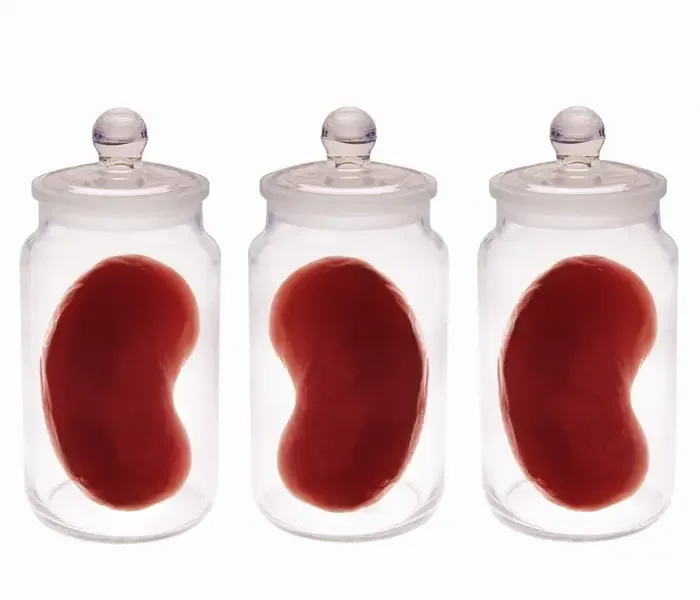 FIA Identifies Illegal Kidney Transplant Networks Operating Across Khyber Pakhtunkhwa