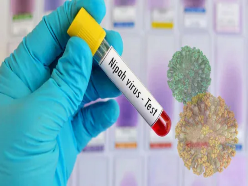 Pakistan on High Alert as Nipah Virus Raises Fears of Deadly Spread