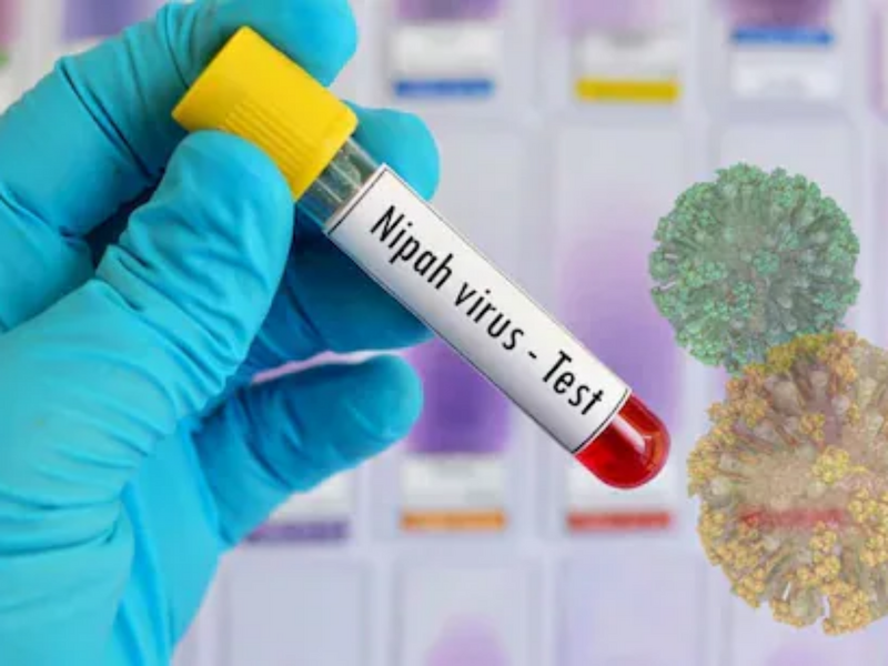 Sindh Government Issues Health Advisory Over Nipah Virus Risk